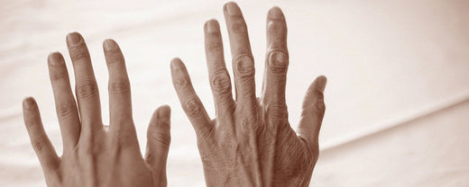 Close-up image of aged hands, showcasing the natural signs of skin aging with visible wrinkles and spots