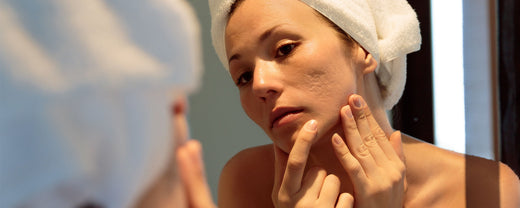 A close-up of a woman examining acne scars on her face in front of a mirror.