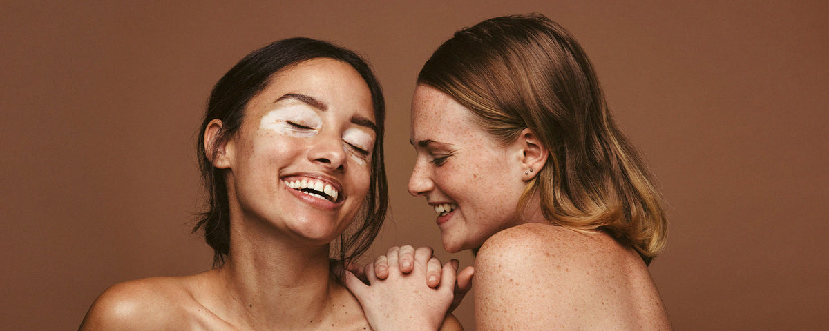 Hyperpigmentation: Guide to Treating Uneven Skin Tone