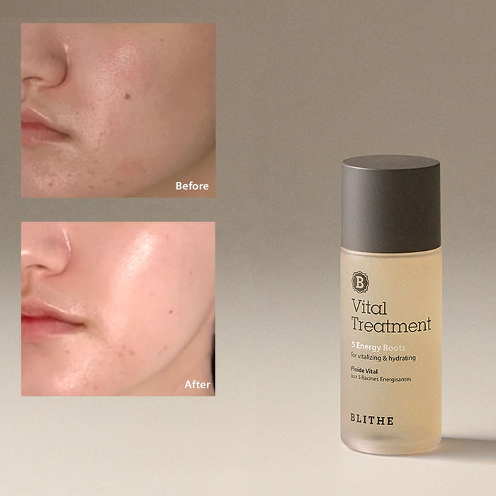 Transformative Blithe skincare products delivering remarkable results: Before and after image showcasing visibly improved skin texture, tone, and radiance