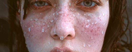 Close-up image of a woman's face with water droplets on her skin, symbolizing hydration and the focus on deep moisturization in skincare practices.