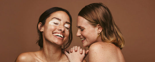 Hyperpigmentation: Guide to Treating Uneven Skin Tone