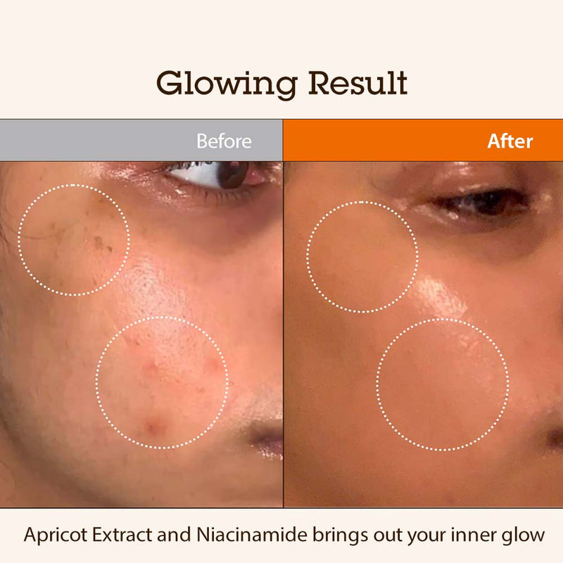 Before and after results of using Blithe Targeted Blemish Serum with Niacinamide 5.0, showing improved skin texture and glow.