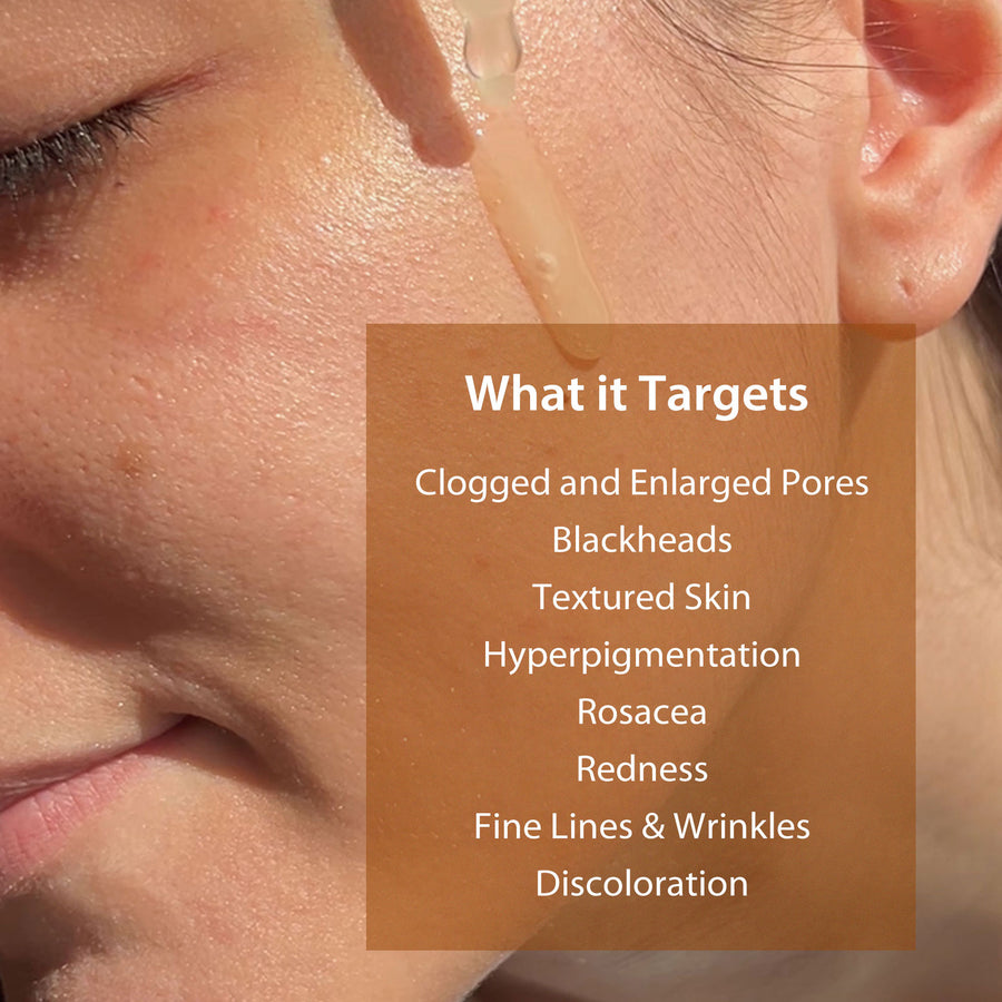 An image that states that niacinamide face serum targets clogged and enlarged pores, blackheads, textured skin, hyperpigmentation, rosacea, redness, fine lines and wrinkles, and discoloration